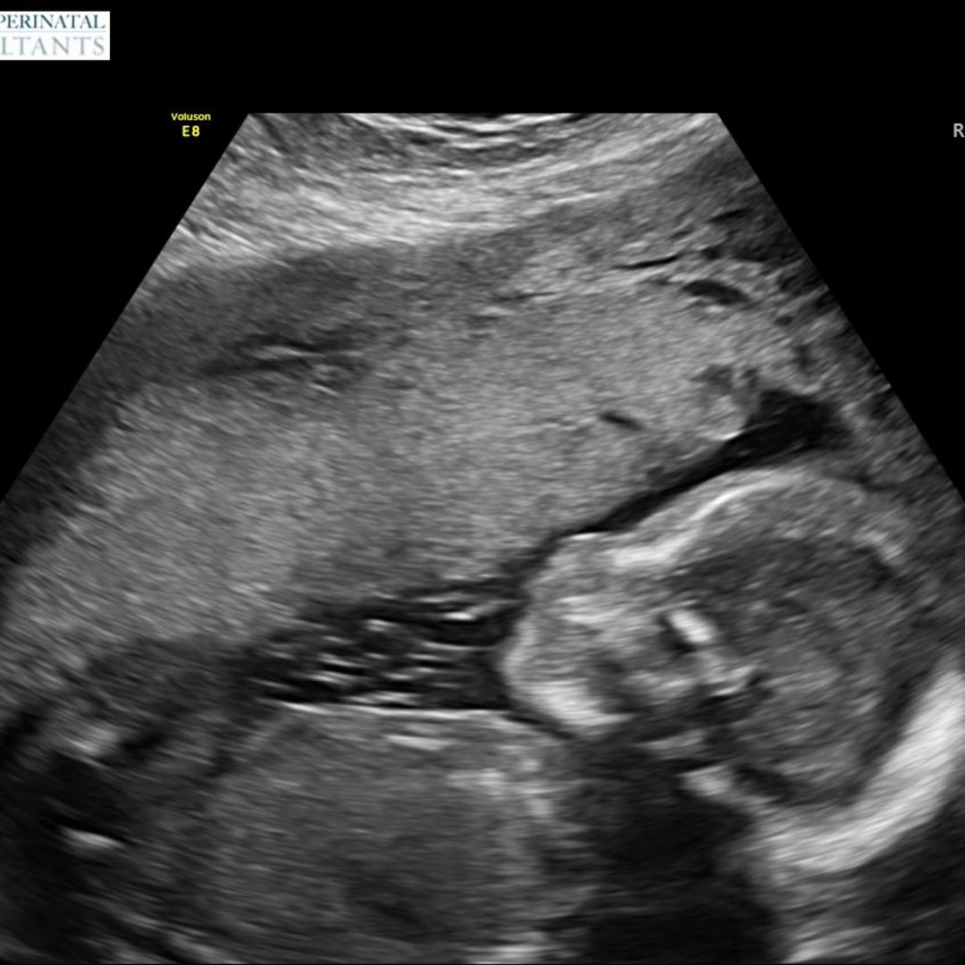 Photo shared by Sarah for their Babylist baby registry.