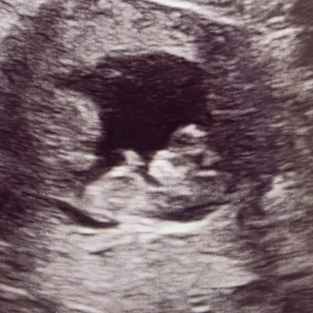 Photo shared by Daultyn for their Babylist baby registry.