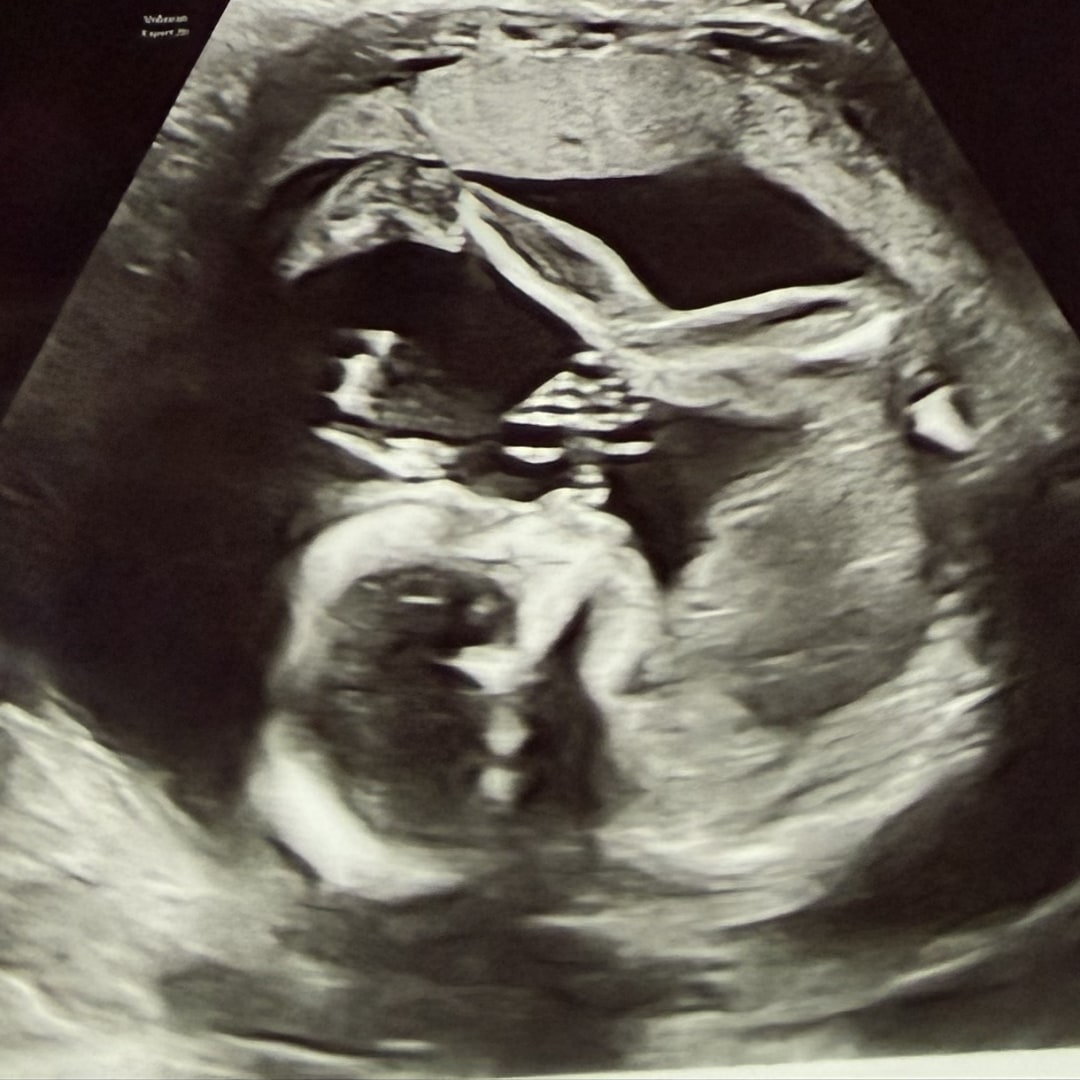 Photo shared by Amanda for their Babylist baby registry.