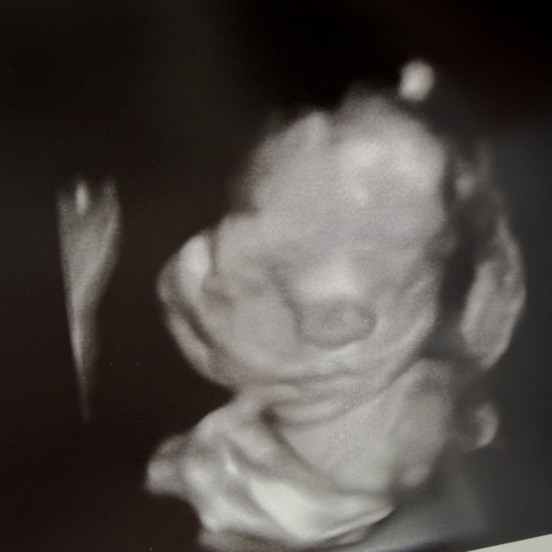Photo shared by Amber for their Babylist baby registry.