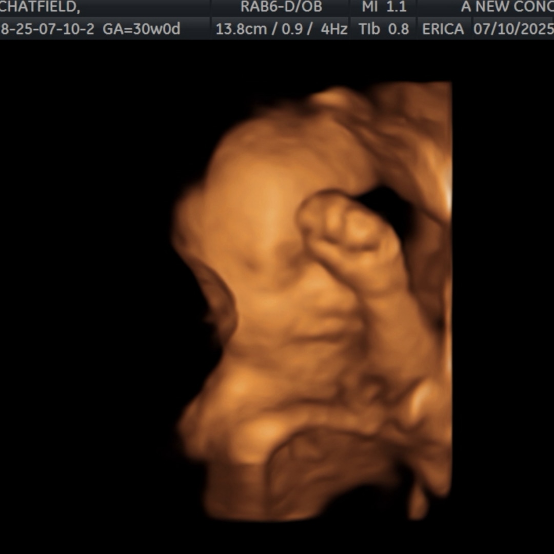 Photo shared by Kayla for their Babylist baby registry.