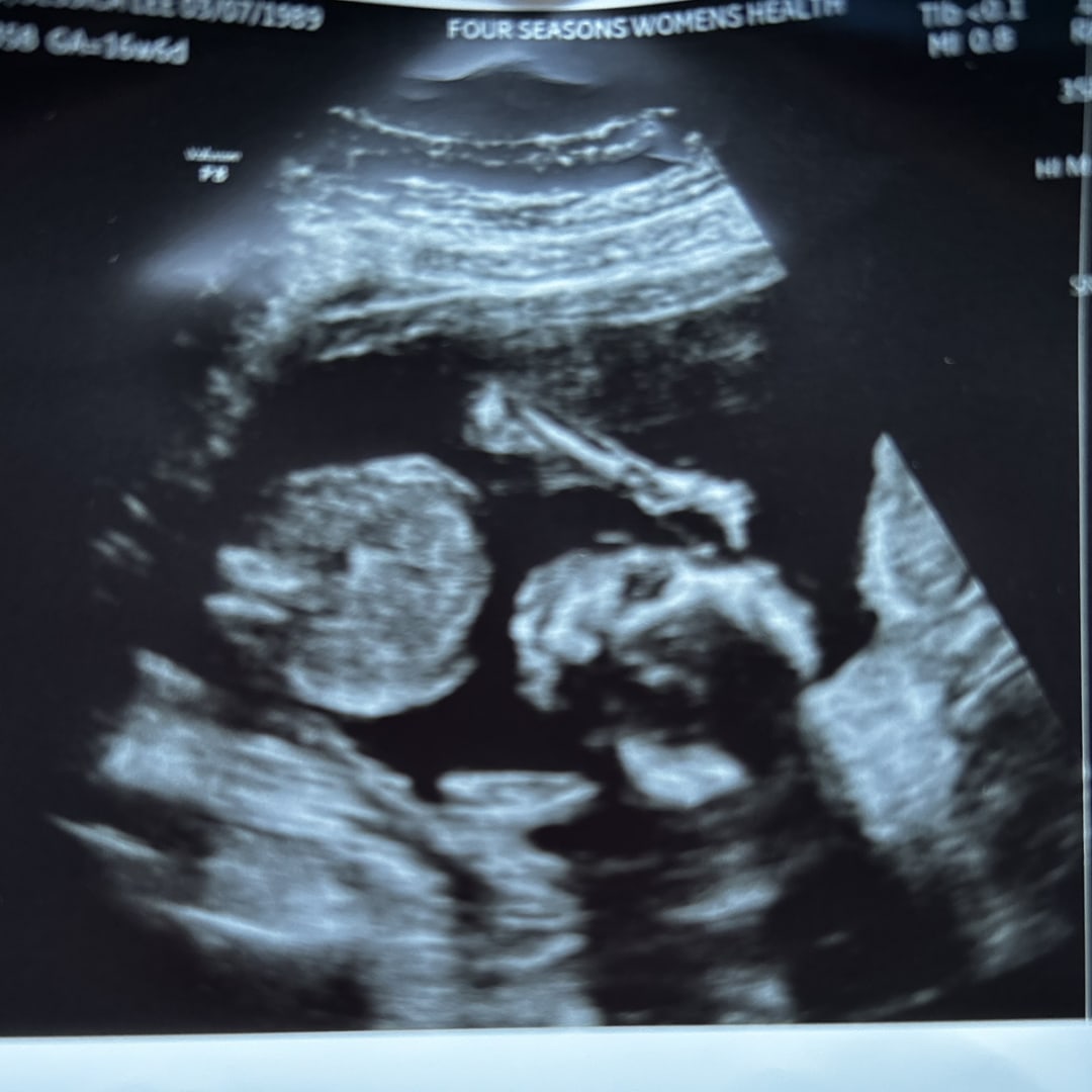 Photo shared by Jessica for their Babylist baby registry.