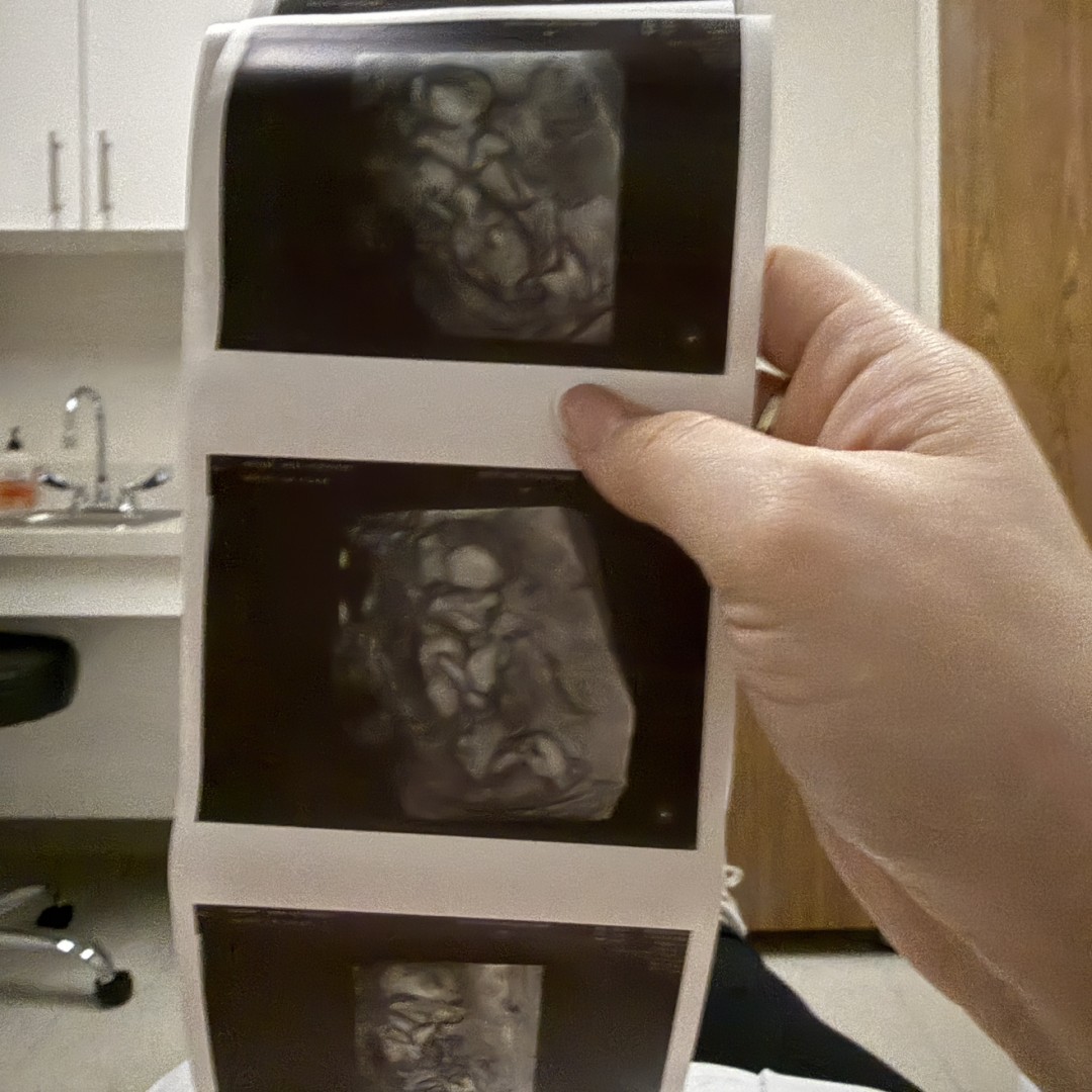 Photo shared by Annie for their Babylist baby registry.