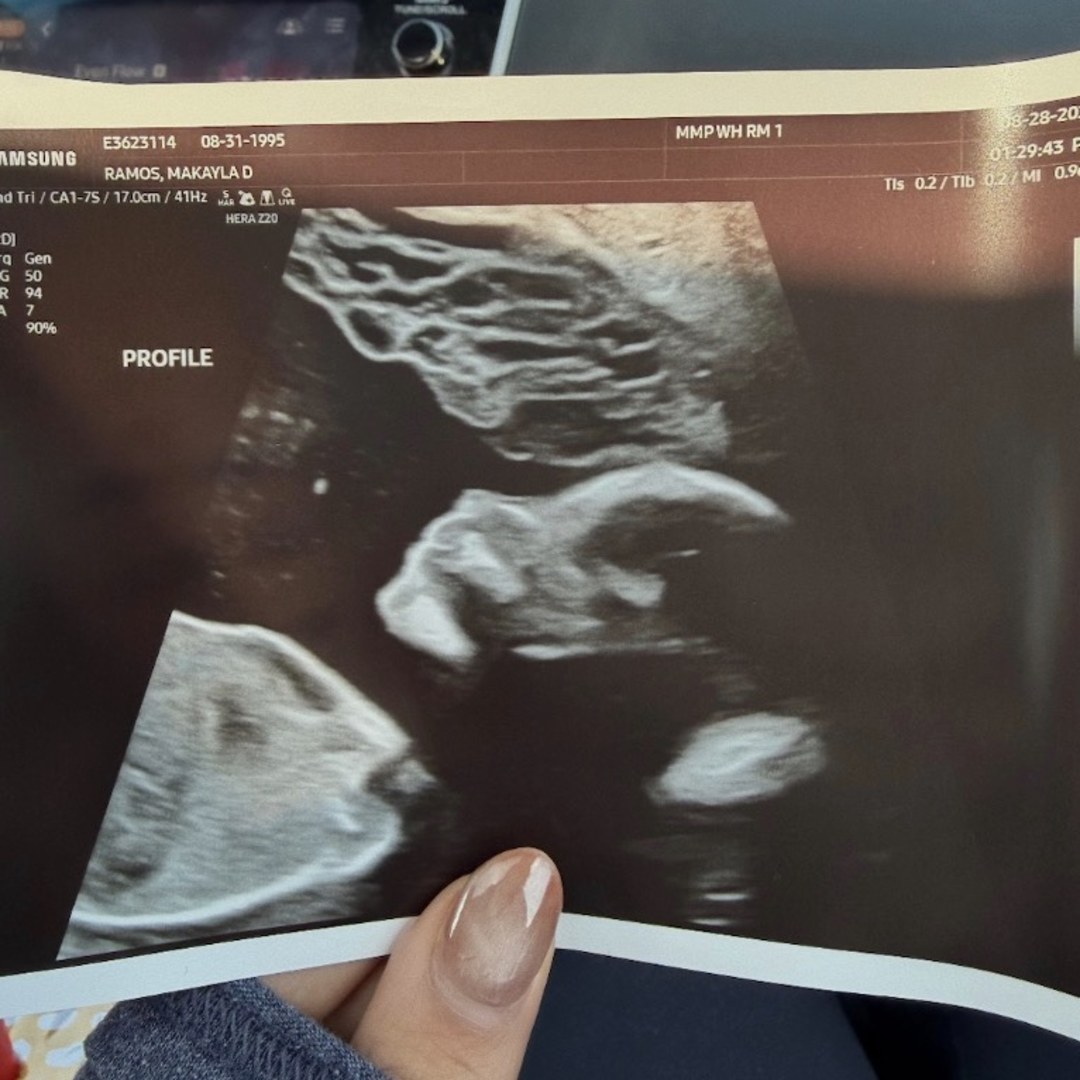 Photo shared by Makayla for their Babylist baby registry.