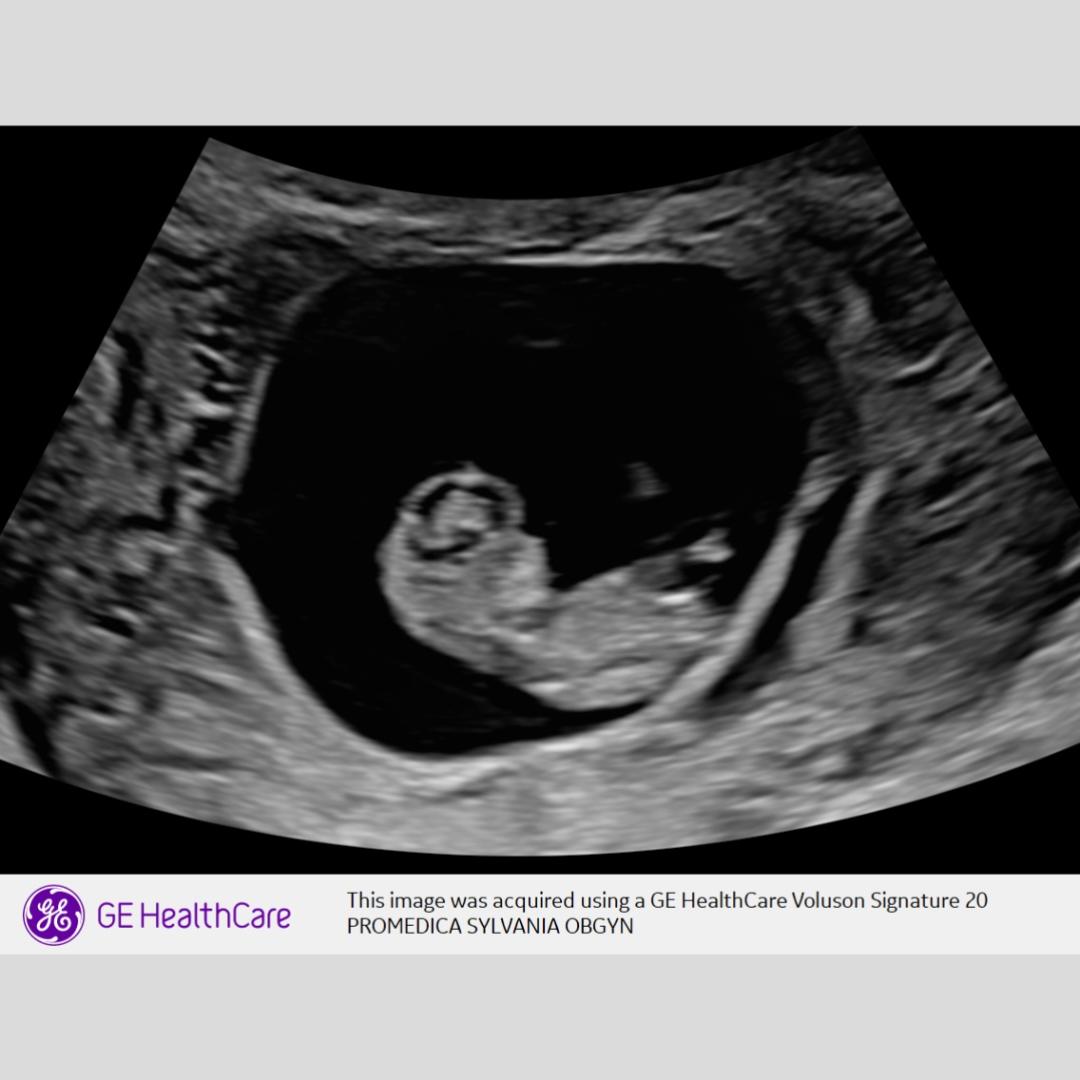 Photo shared by Shania for their Babylist baby registry.