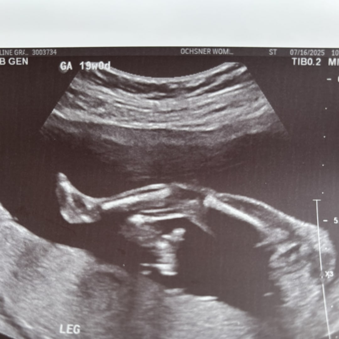 Photo shared by Madeline for their Babylist baby registry.