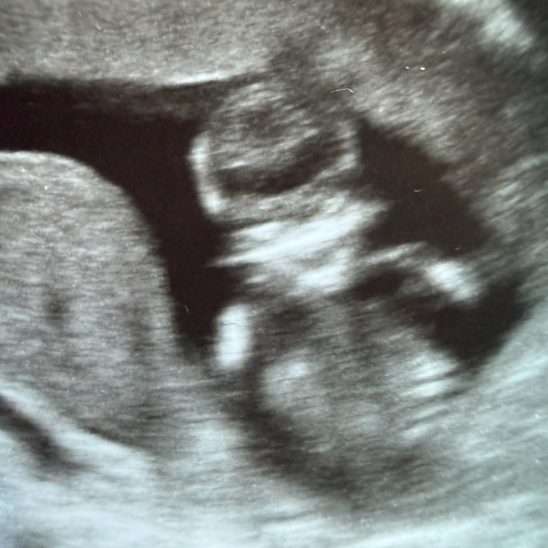 Photo shared by Cynthea for their Babylist baby registry.