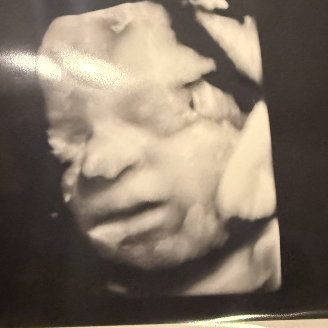 Photo shared by Aliyah for their Babylist baby registry.