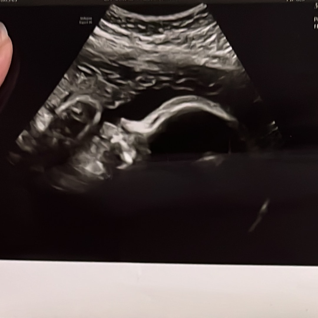 Photo shared by Brihanna for their Babylist baby registry.