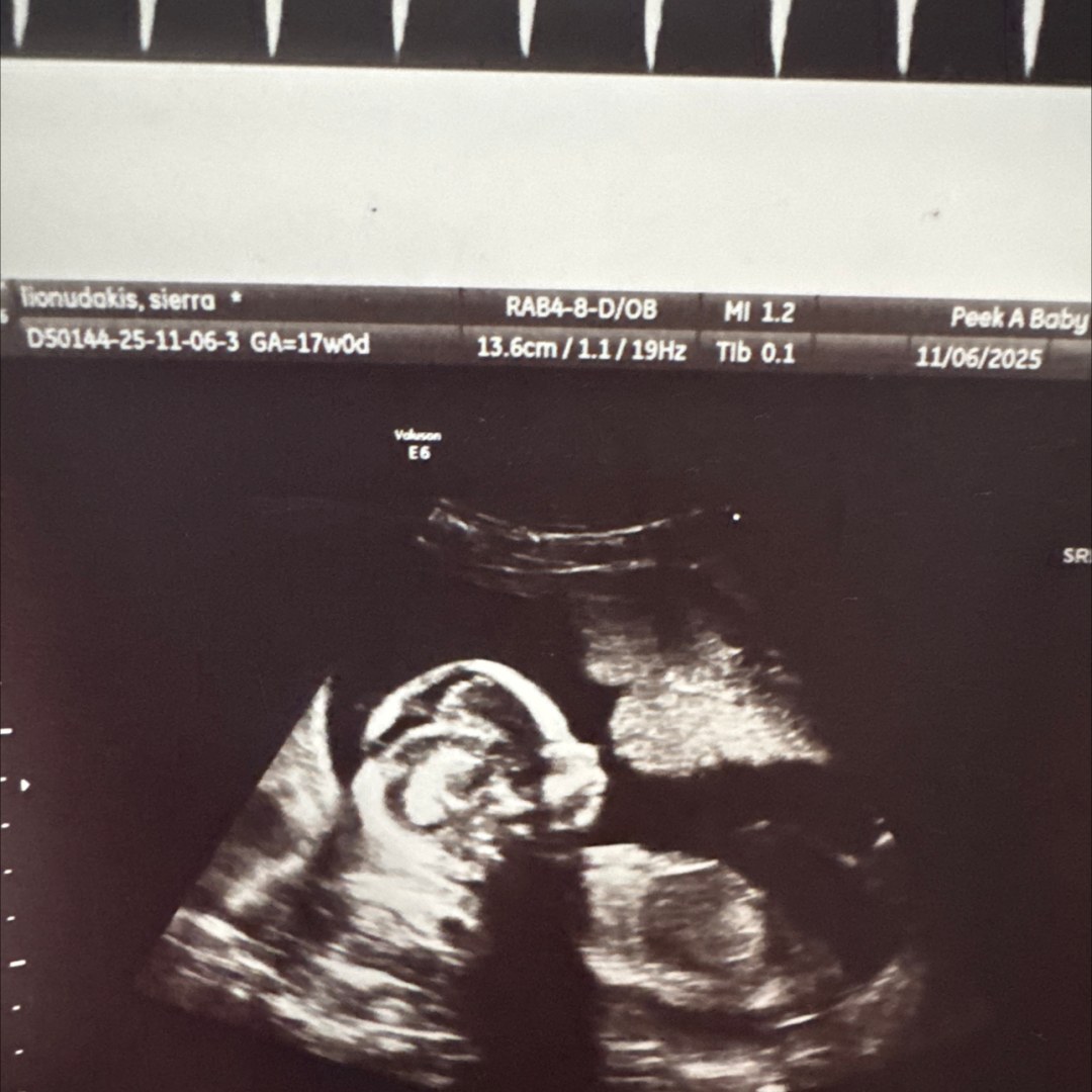 Photo shared by Sierra for their Babylist baby registry.