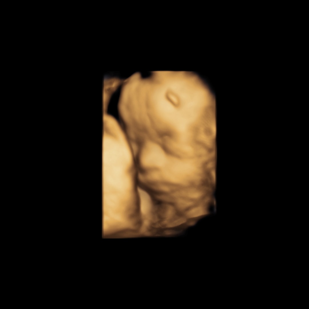 Photo shared by Danielle for their Babylist baby registry.