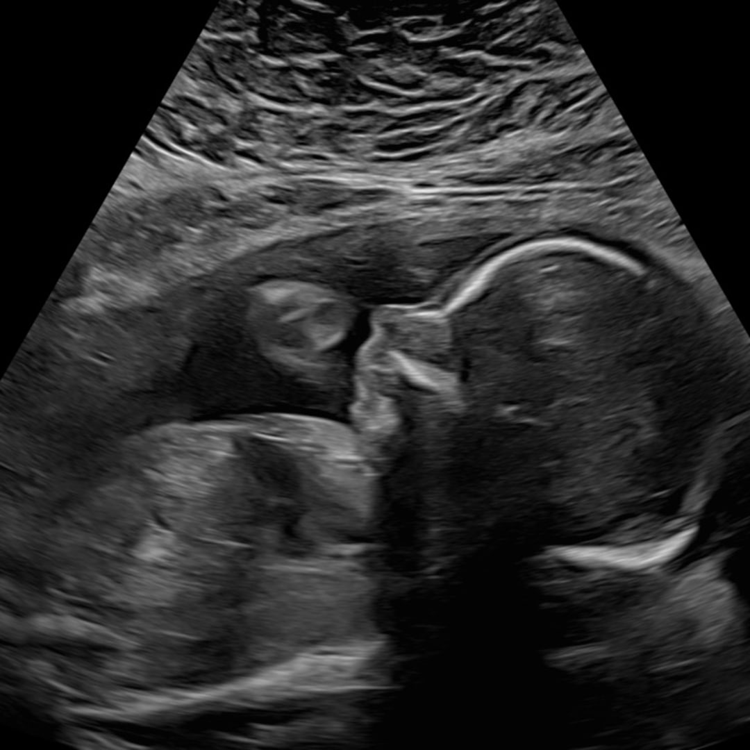 Photo shared by Hannah for their Babylist baby registry.
