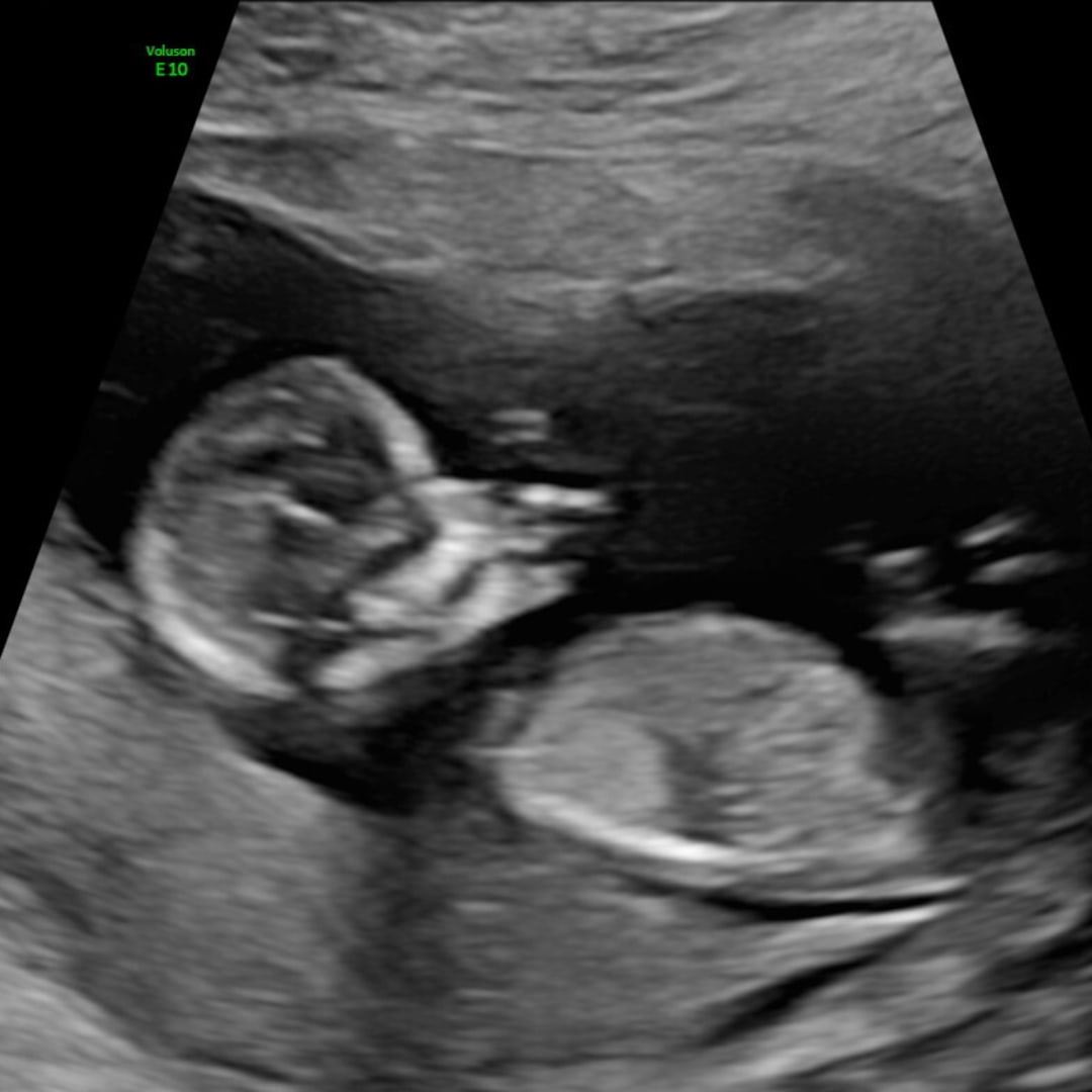 Photo shared by Veronica for their Babylist baby registry.