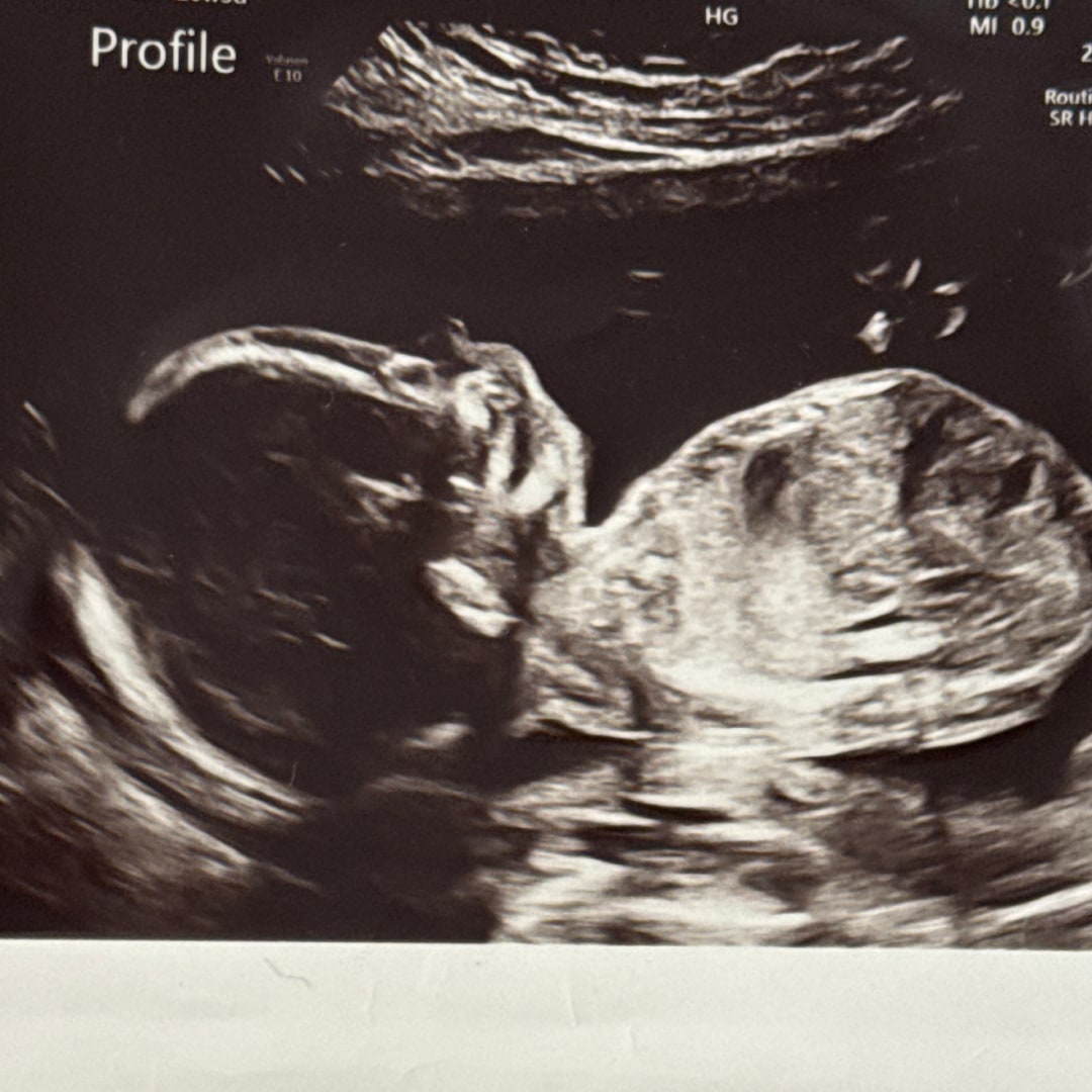 Photo shared by Larisa for their Babylist baby registry.