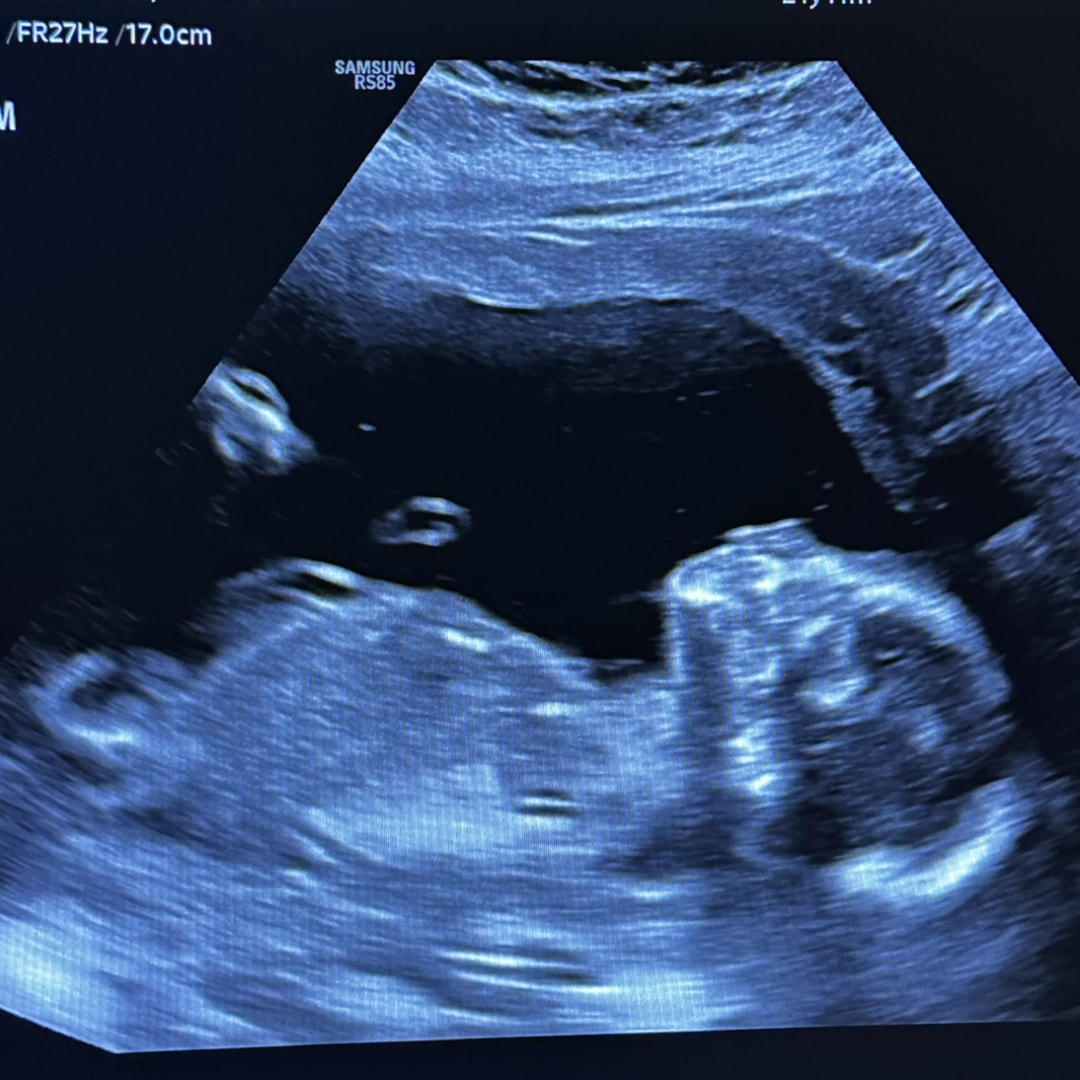 Photo shared by YARY for their Babylist baby registry.