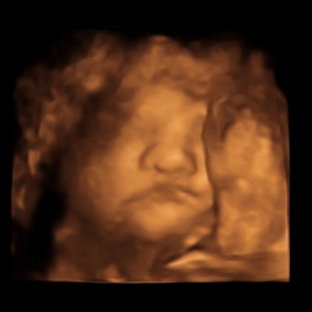 Photo shared by Brenda for their Babylist baby registry.
