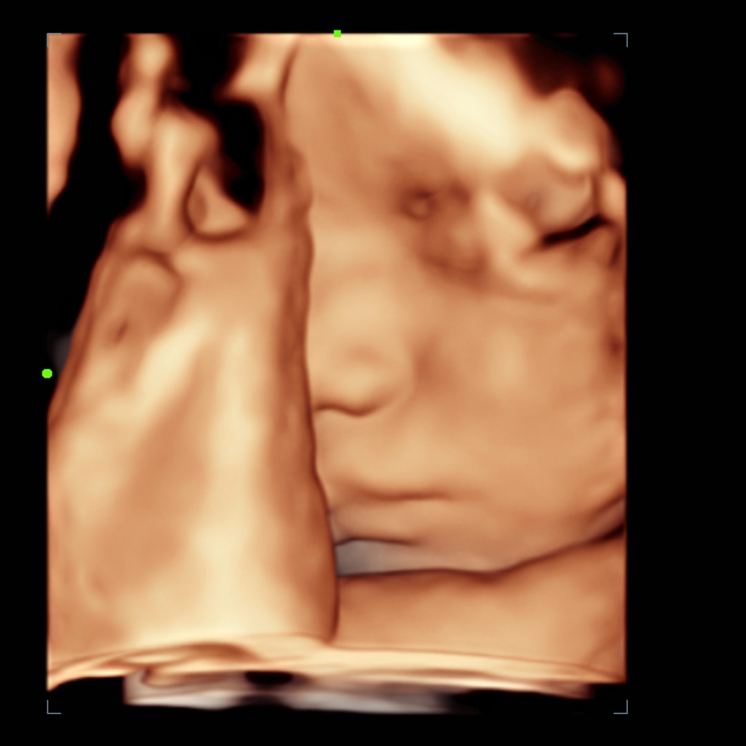 Photo shared by Claudia for their Babylist baby registry.