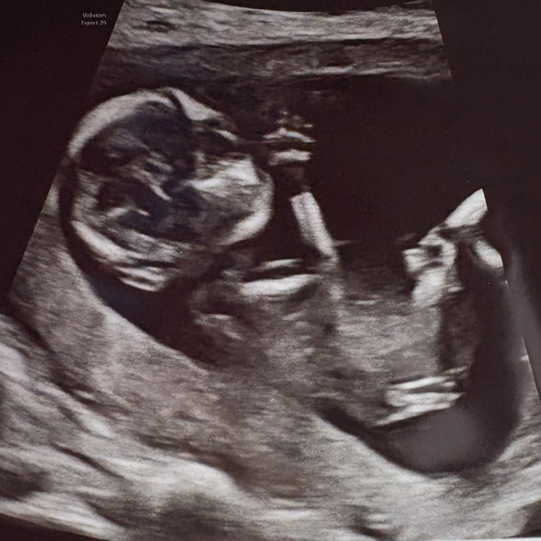 Photo shared by Marissa for their Babylist baby registry.