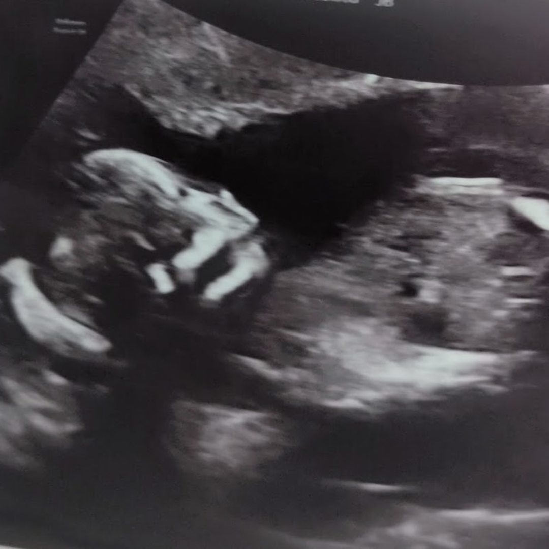 Photo shared by Caitlin for their Babylist baby registry.