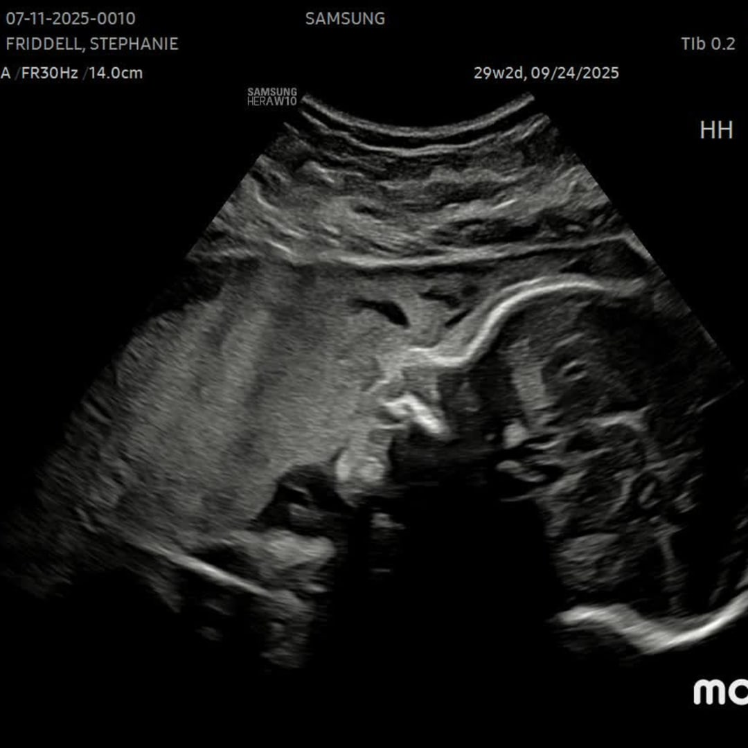 Photo shared by Stephanie for their Babylist baby registry.