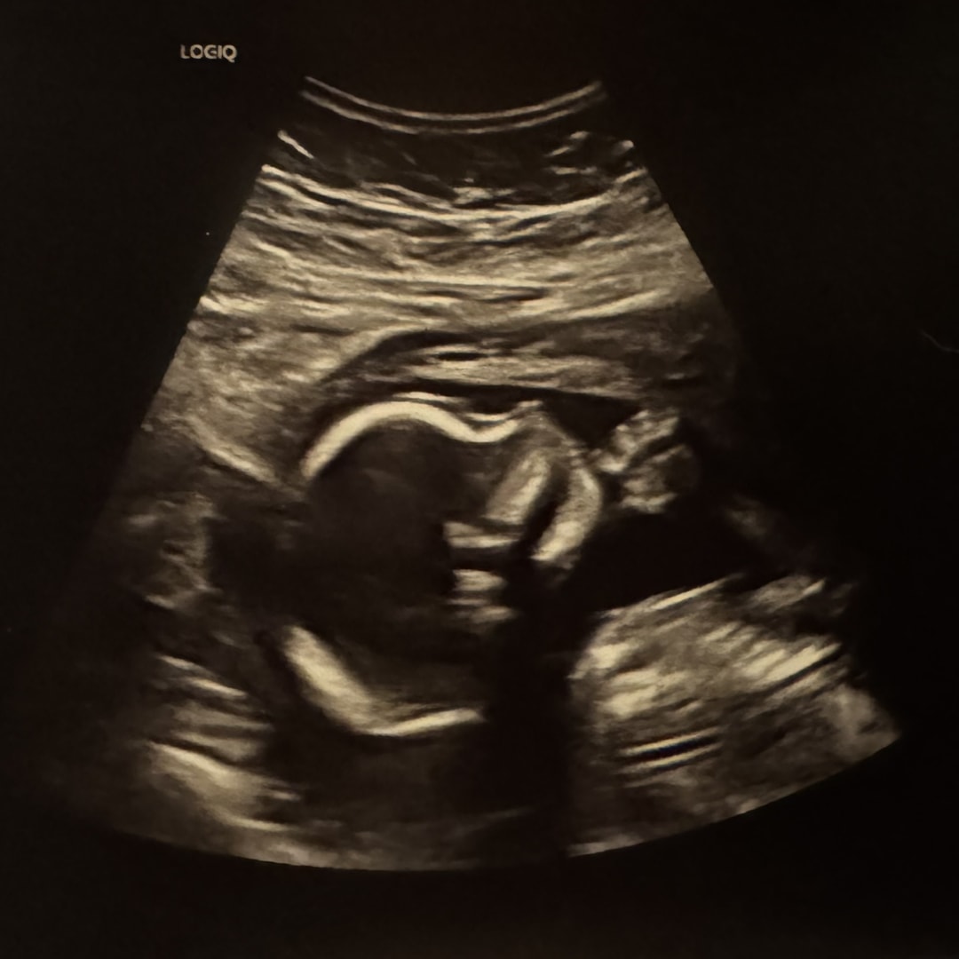 Photo shared by Savannah for their Babylist baby registry.