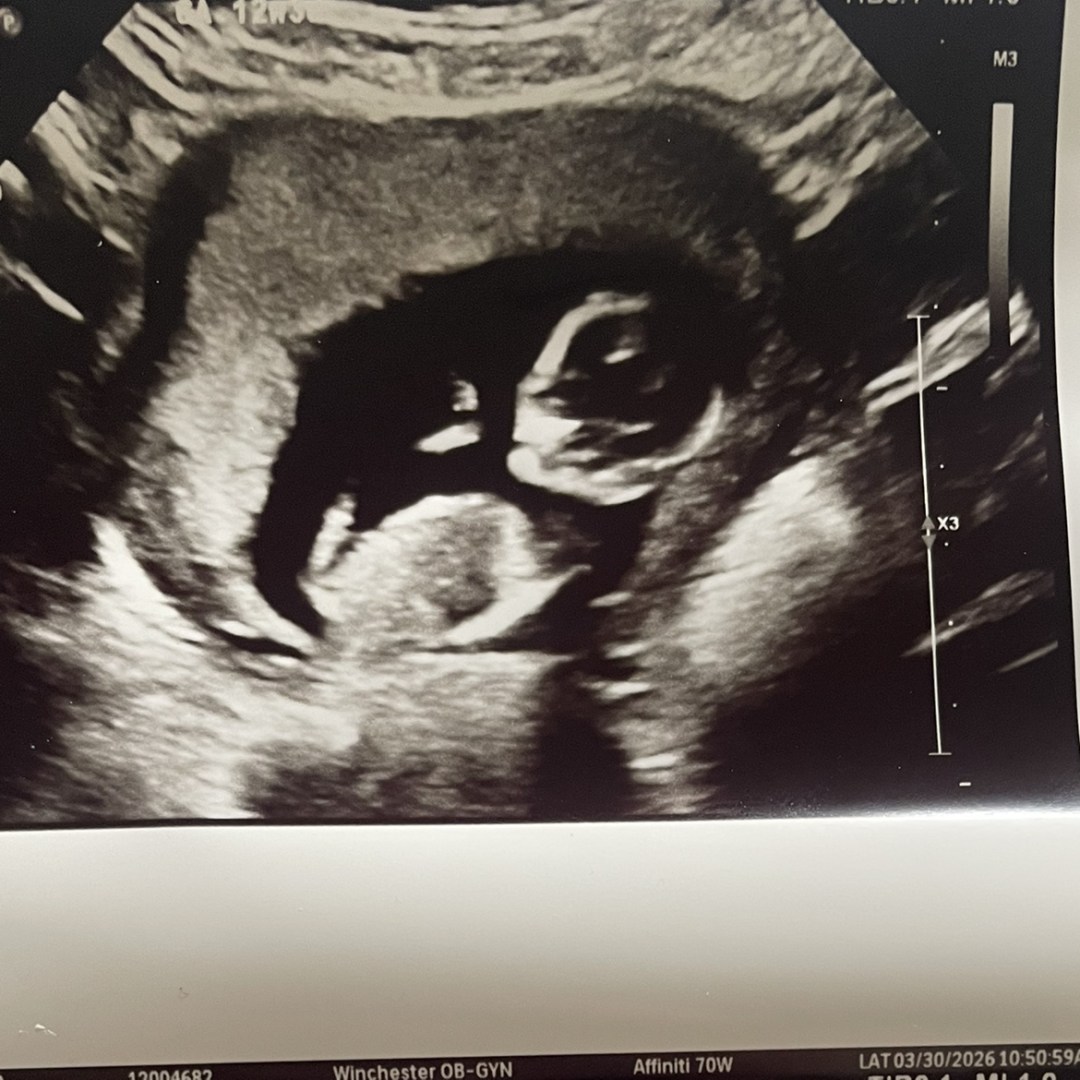 Photo shared by Erica for their Babylist baby registry.