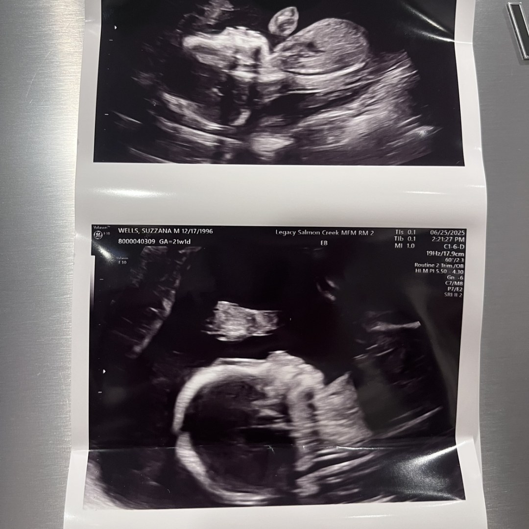 Photo shared by Suzzana for their Babylist baby registry.