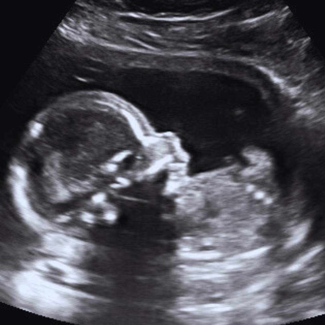 Photo shared by Chrina for their Babylist baby registry.