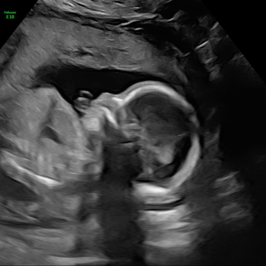 Photo shared by Jordan for their Babylist baby registry.