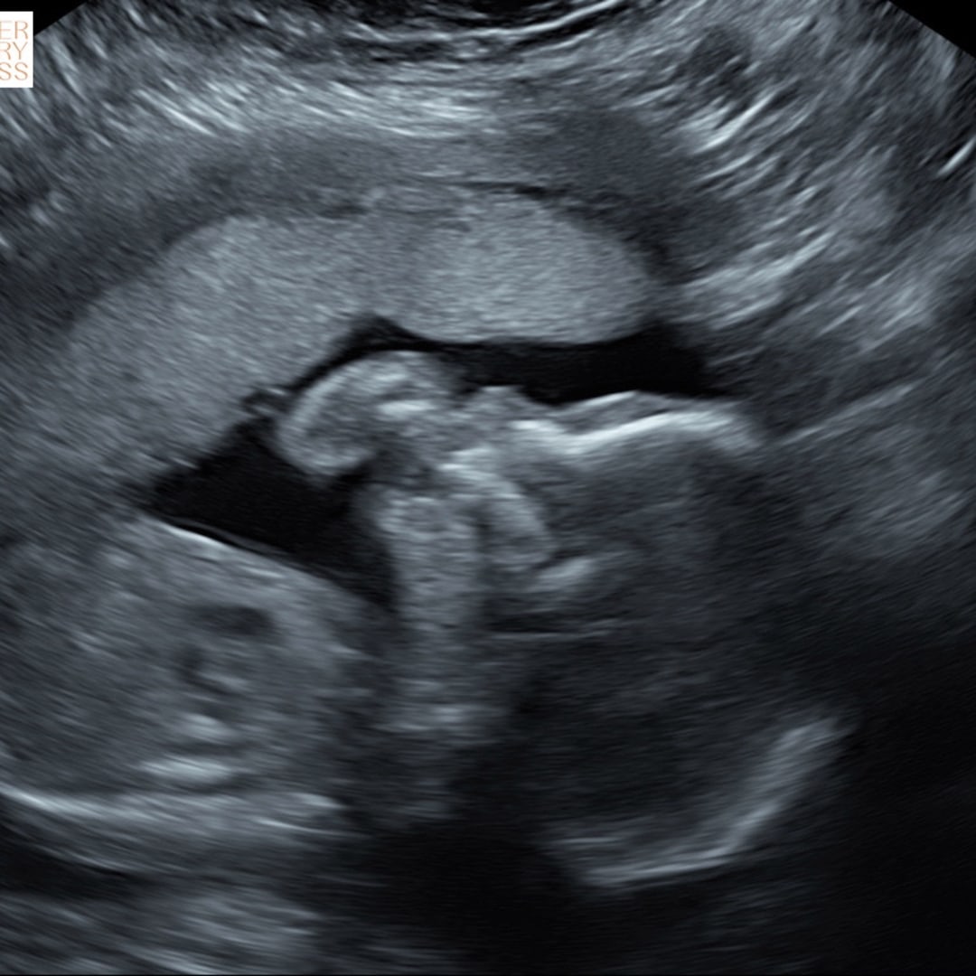Photo shared by Brittny for their Babylist baby registry.