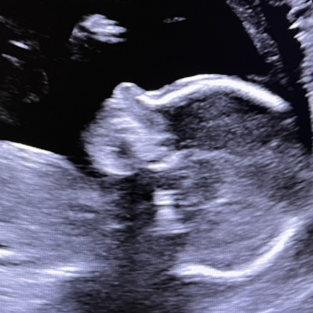 Photo shared by Julia for their Babylist baby registry.