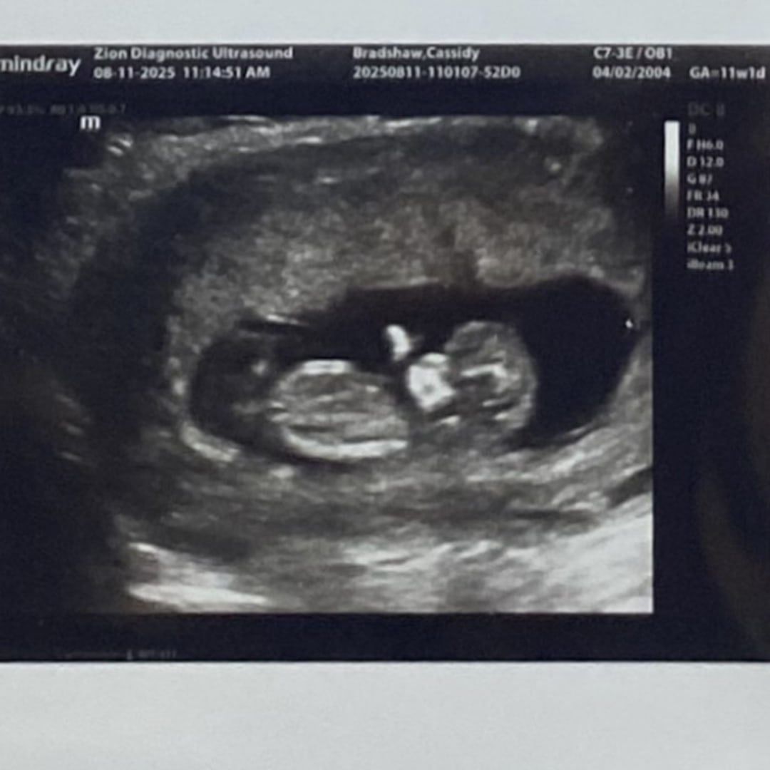 Photo shared by Cass for their Babylist baby registry.