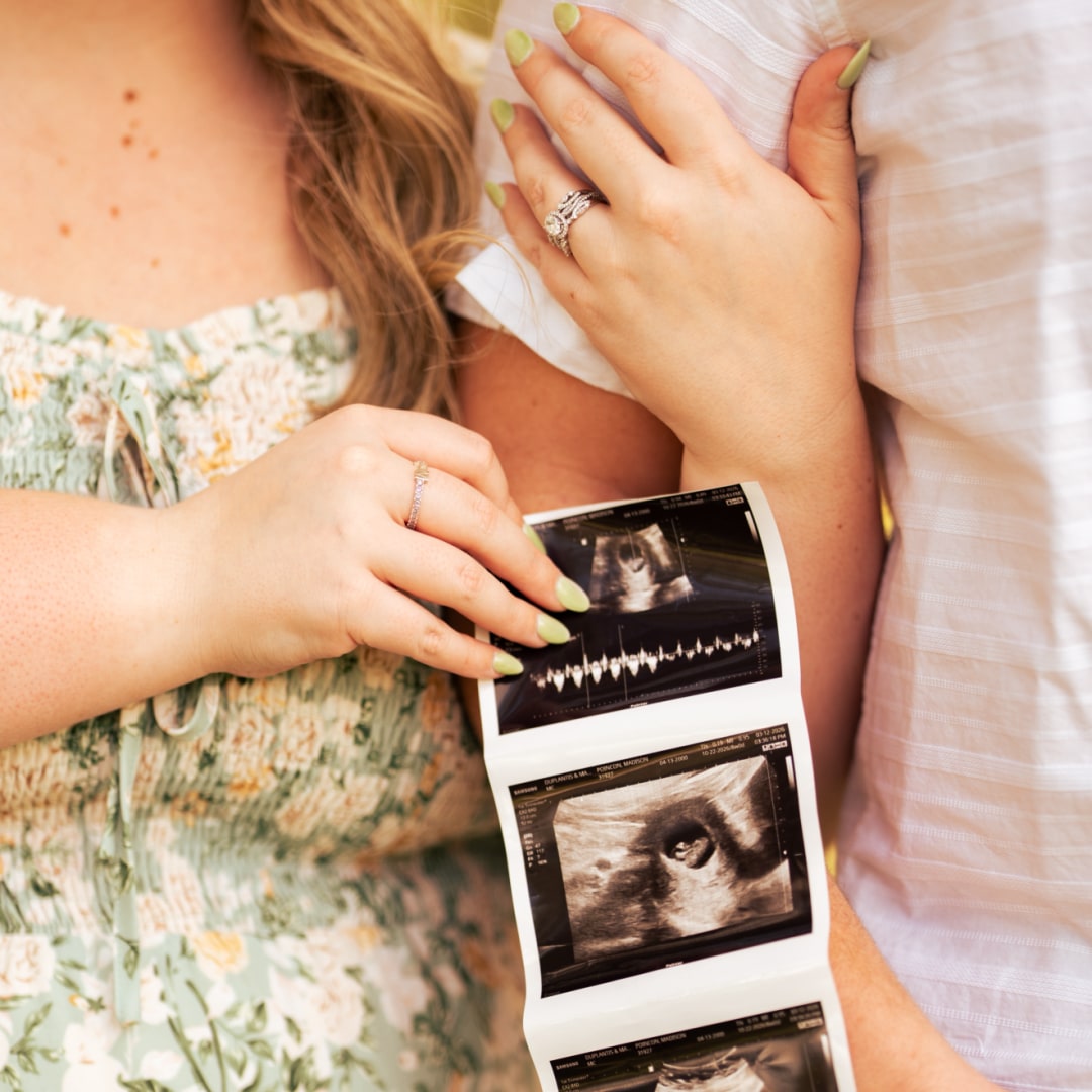 Photo shared by Madison for their Babylist baby registry.