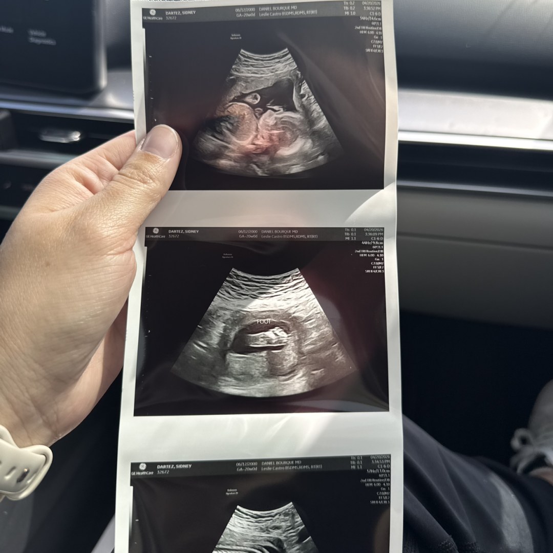 Photo shared by Sidney for their Babylist baby registry.