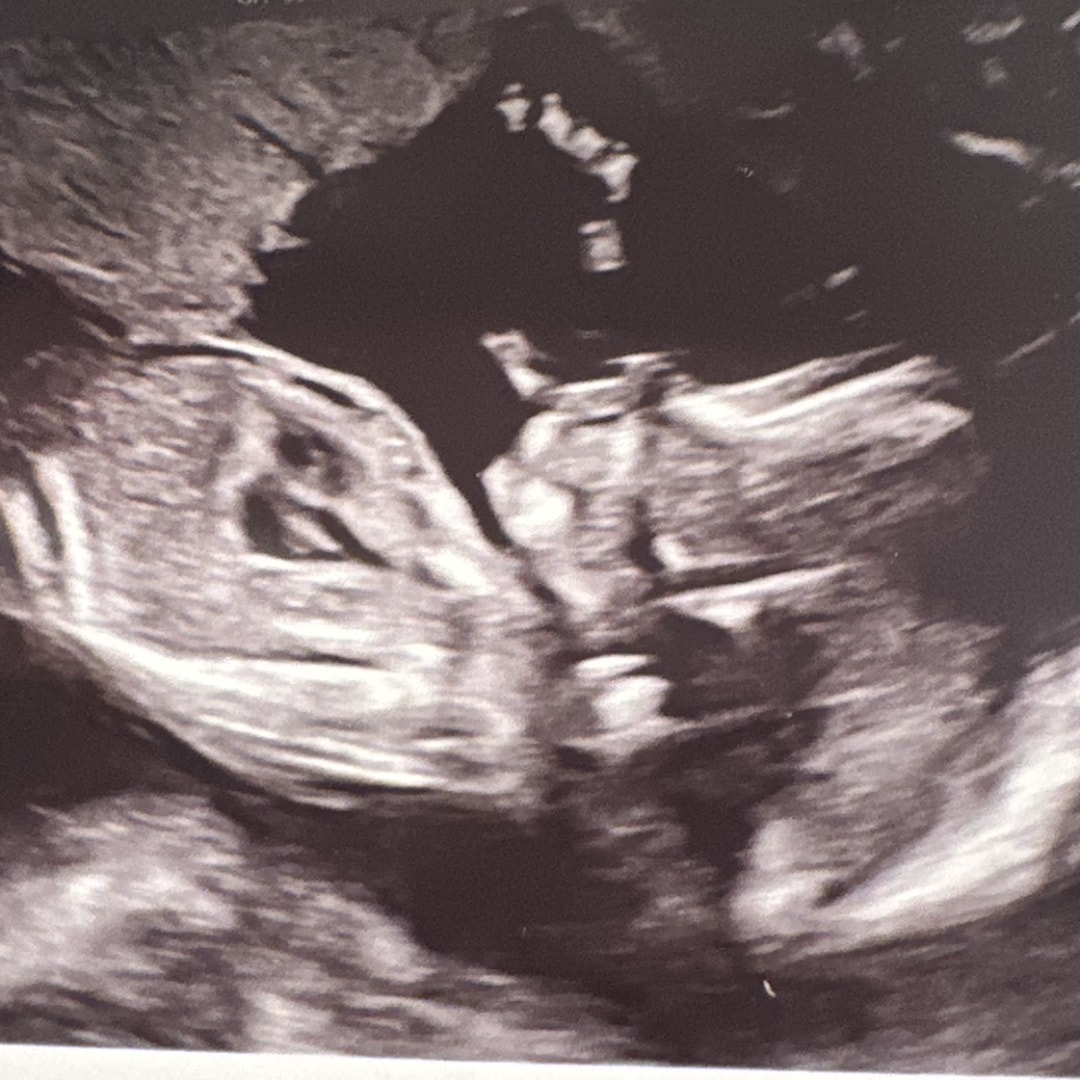 Photo shared by Alexis for their Babylist baby registry.
