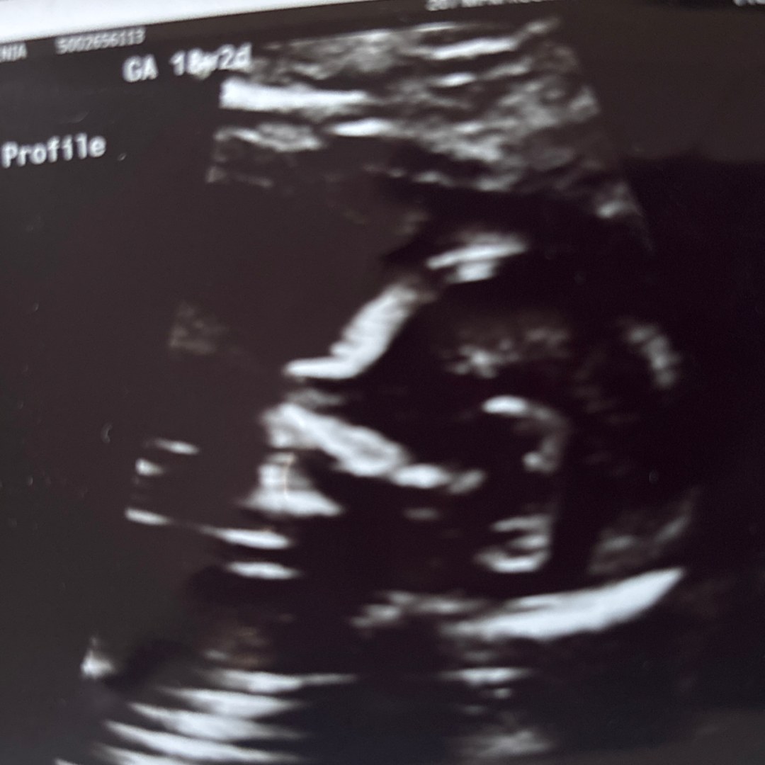 Photo shared by Jessenia for their Babylist baby registry.