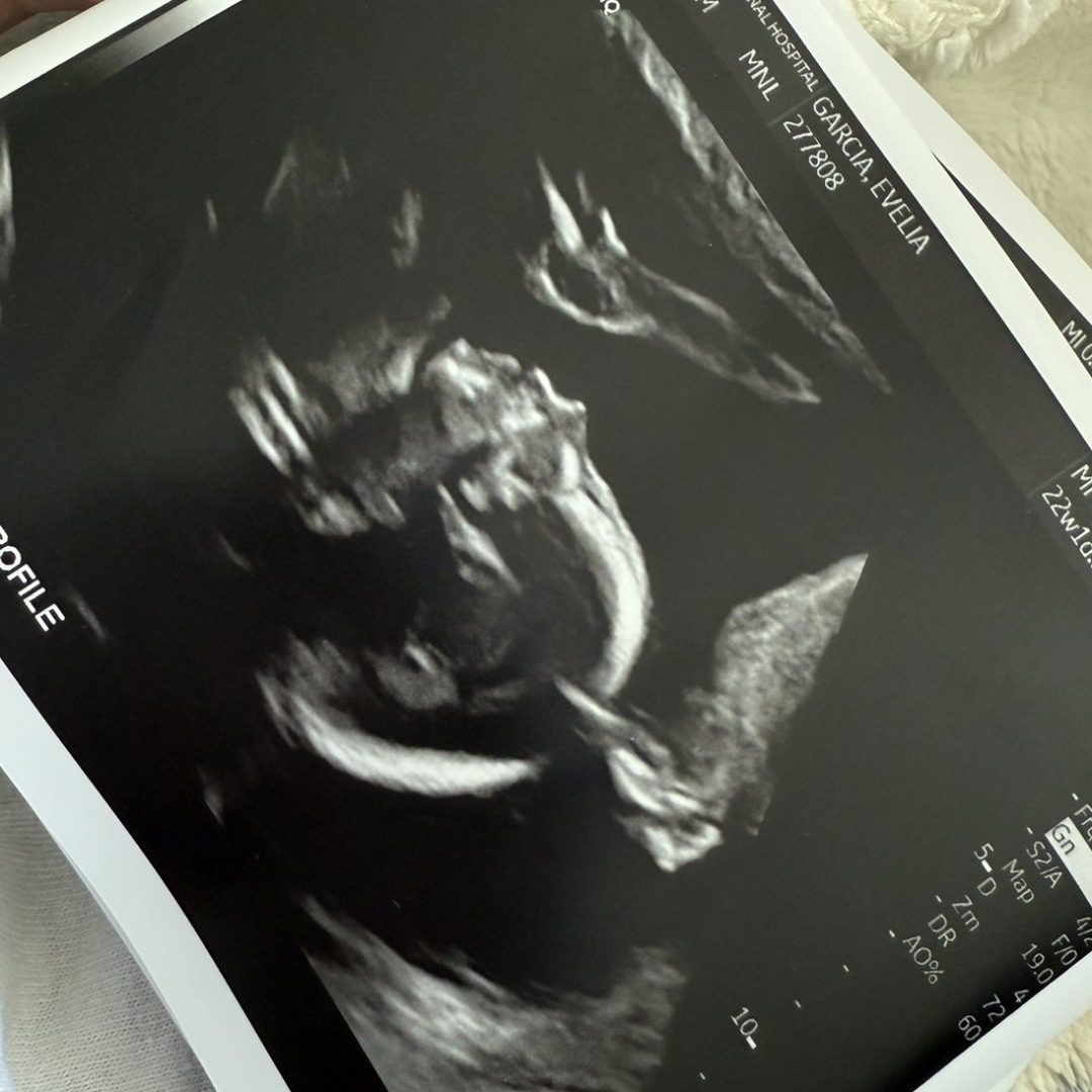Photo shared by Evelia for their Babylist baby registry.