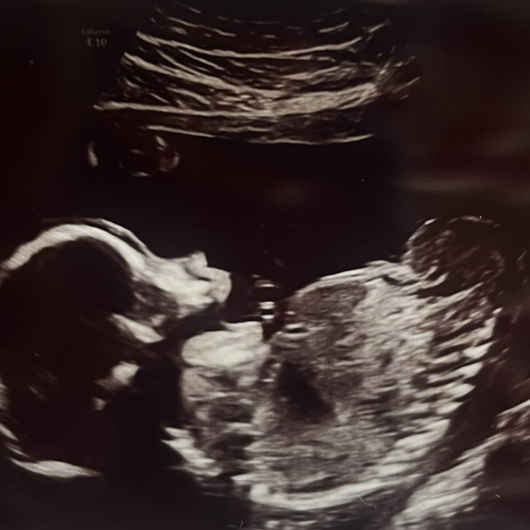 Photo shared by Cheryl for their Babylist baby registry.