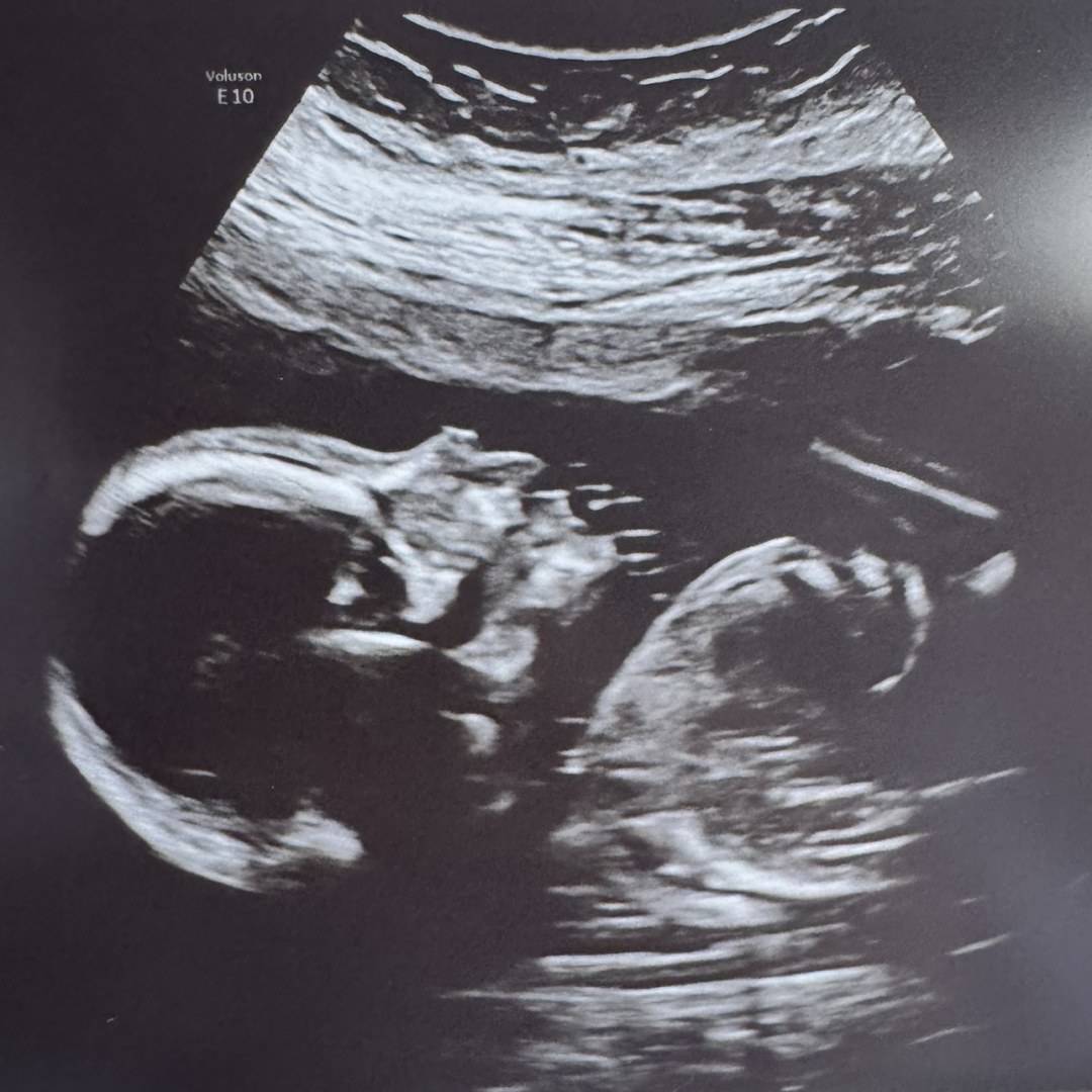 Photo shared by Maranda for their Babylist baby registry.