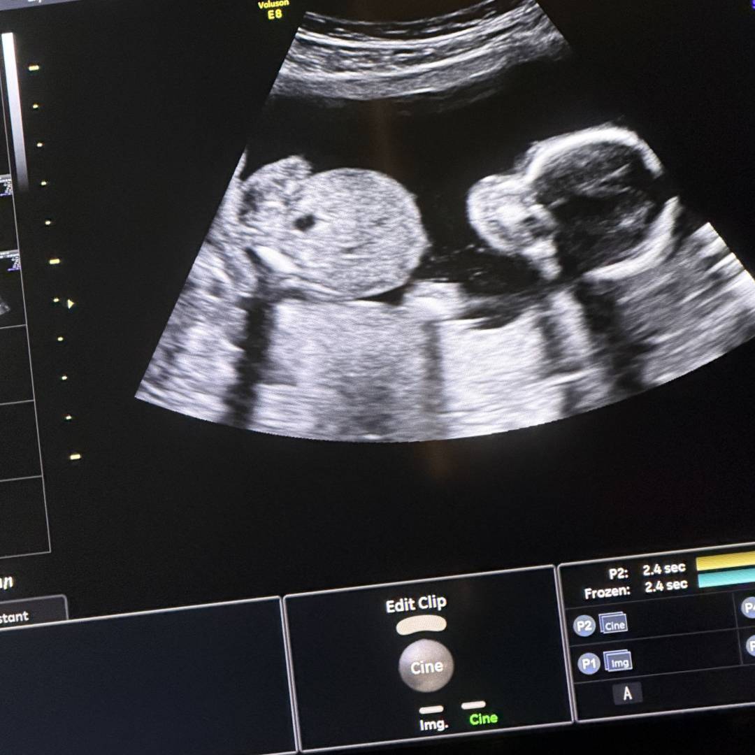 Photo shared by Micaela for their Babylist baby registry.