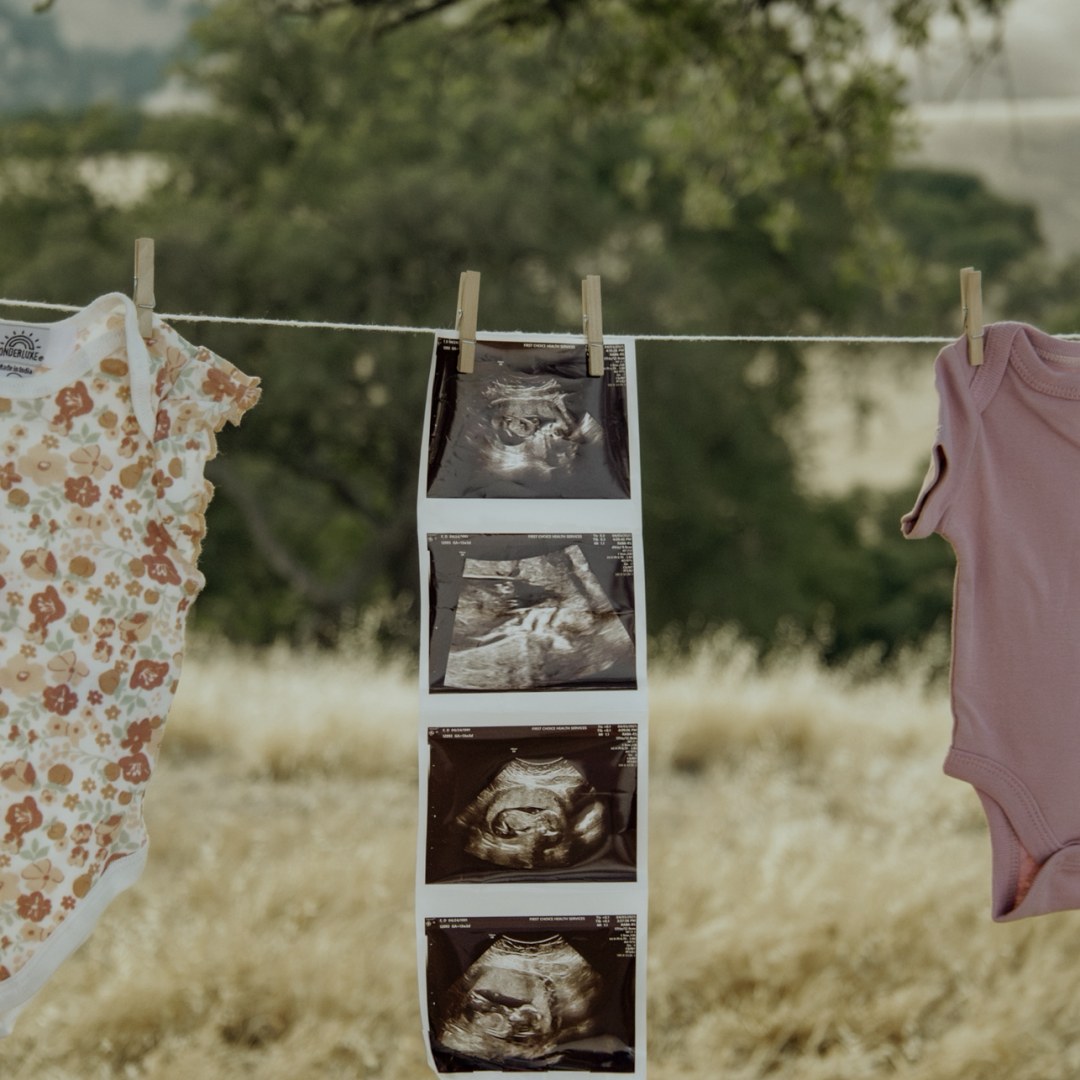Photo shared by Dorian for their Babylist baby registry.
