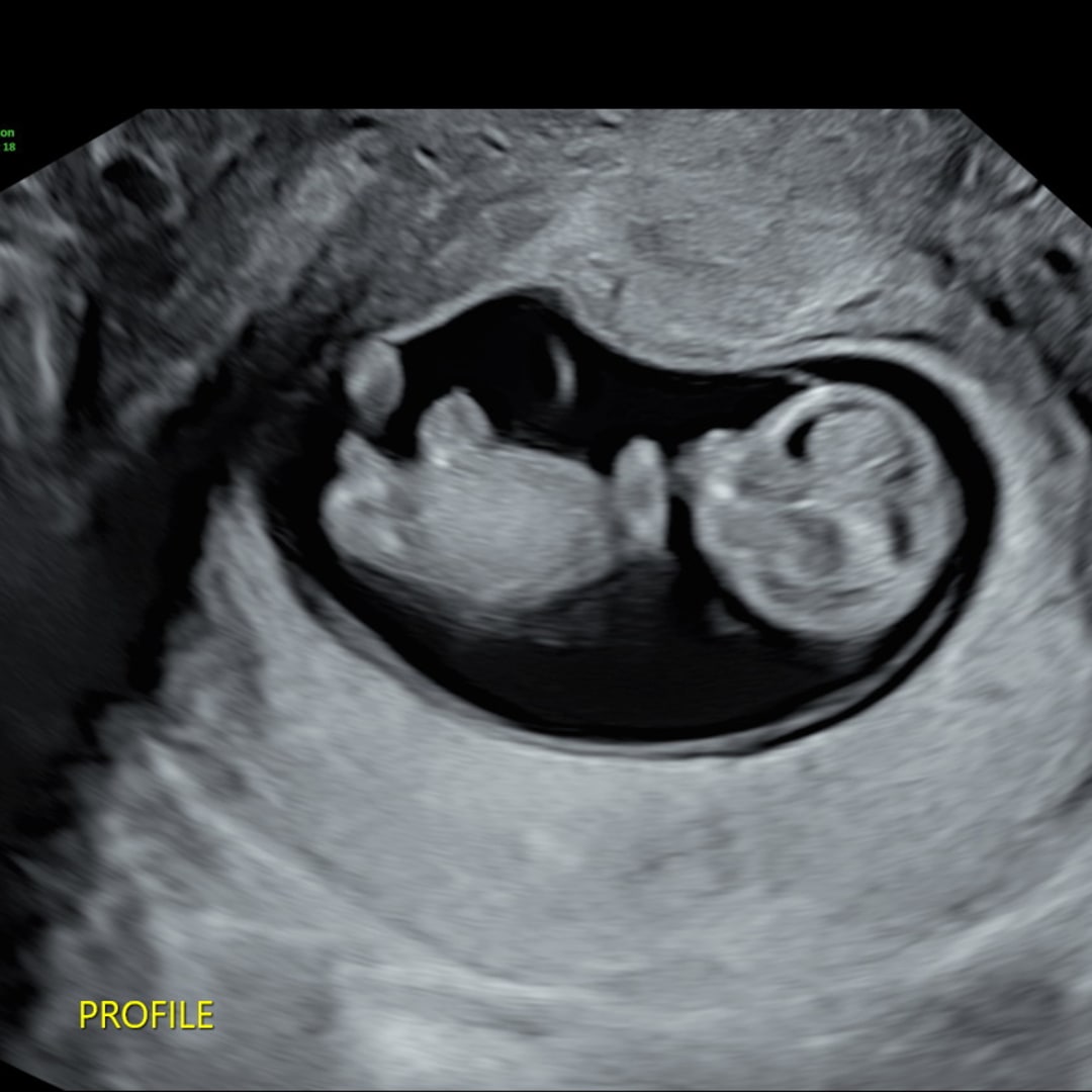Photo shared by Peyton for their Babylist baby registry.