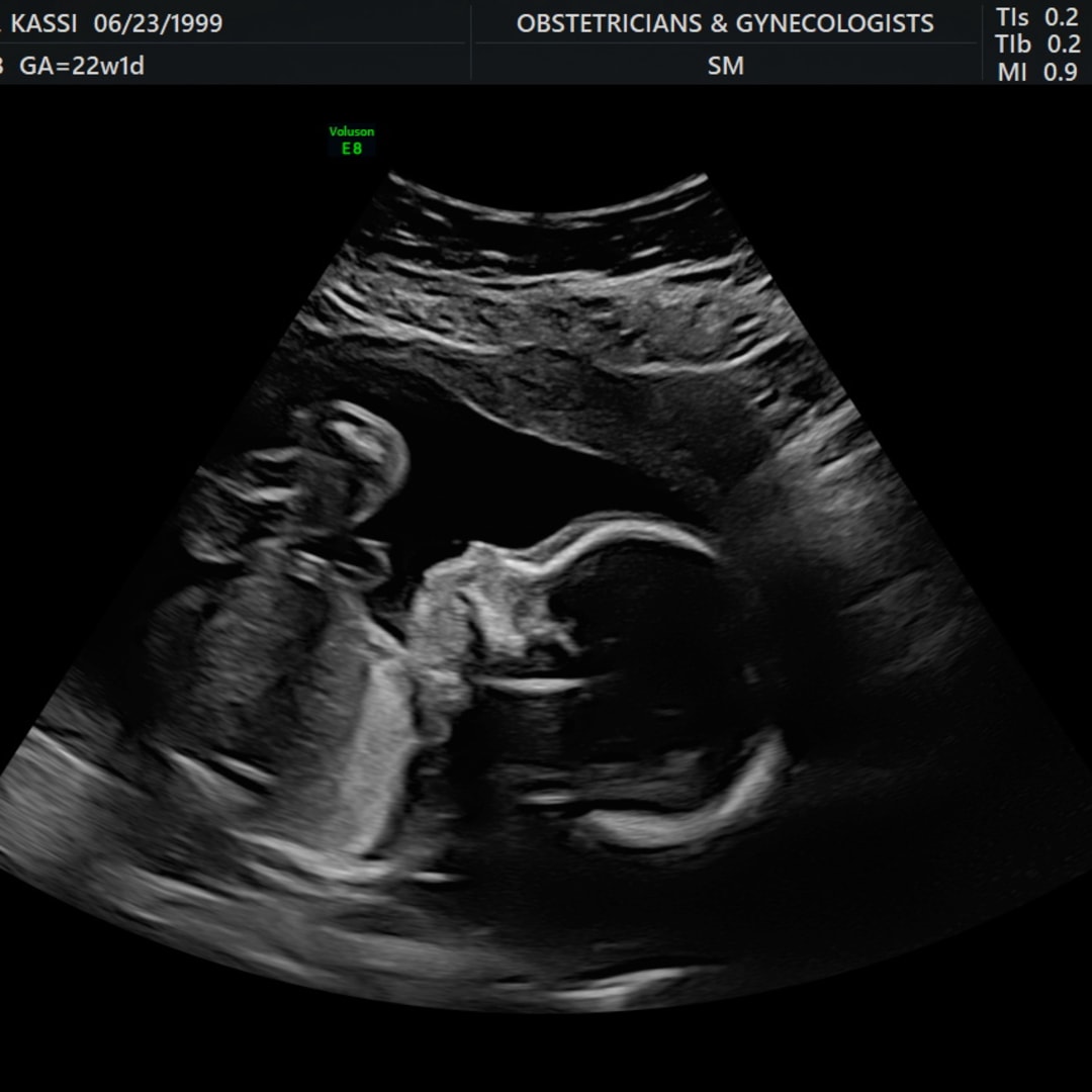 Photo shared by Kassi for their Babylist baby registry.