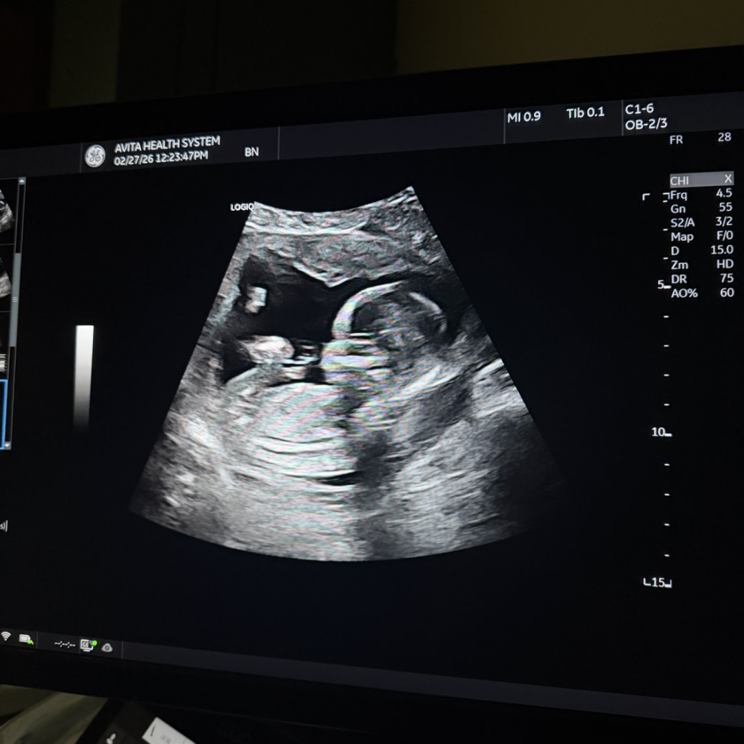 Photo shared by Alivia for their Babylist baby registry.