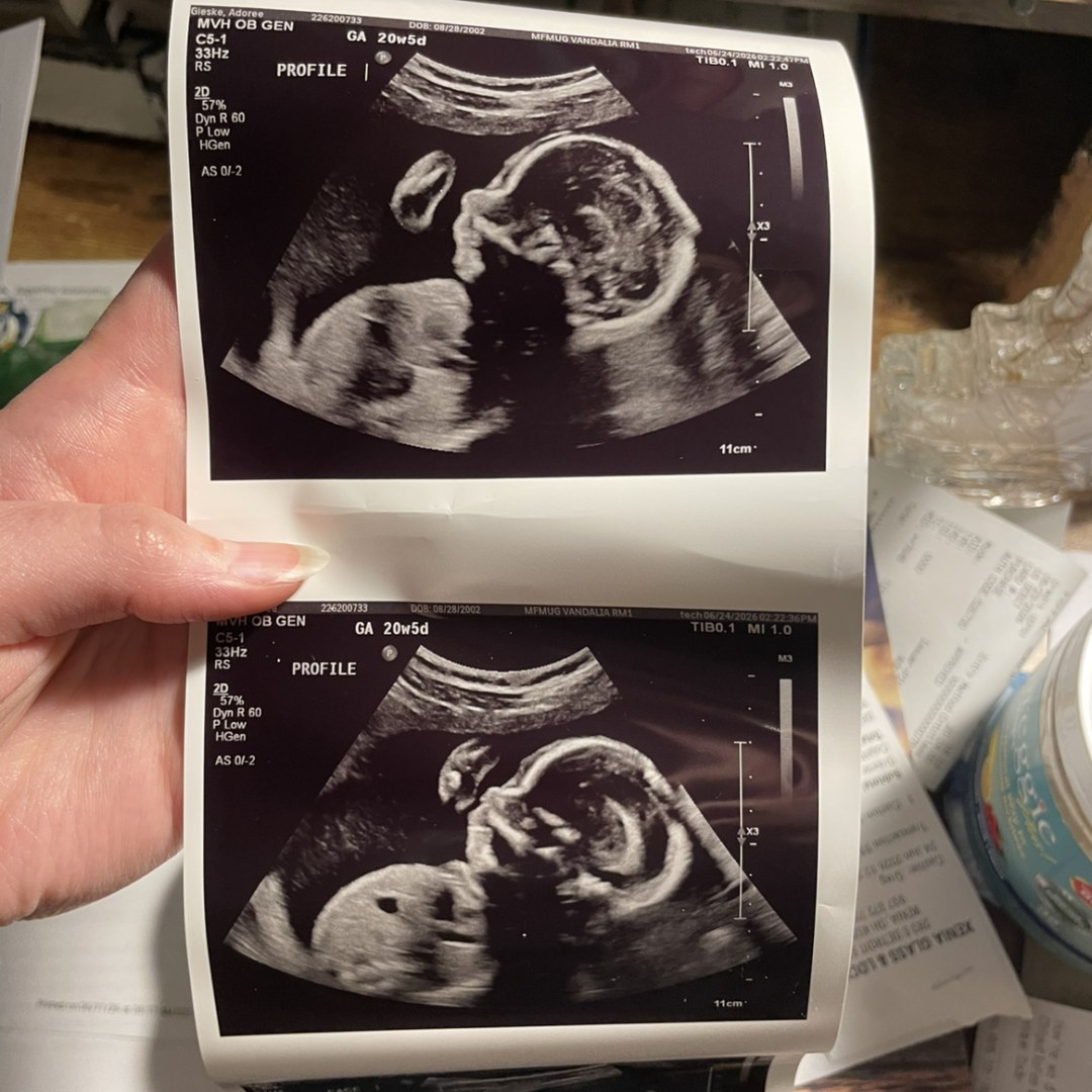 Photo shared by Adoree for their Babylist baby registry.