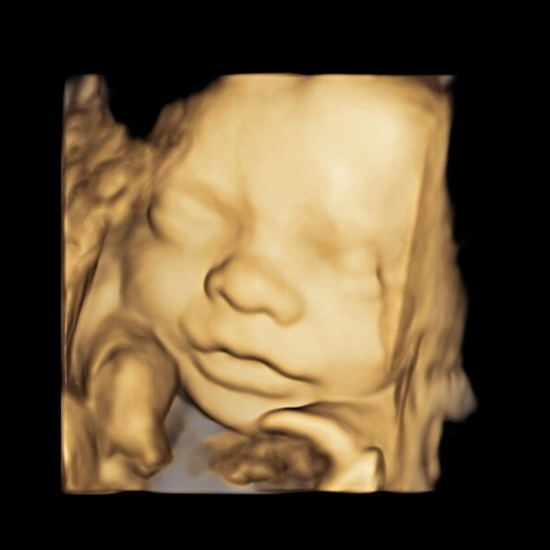Photo shared by Kirk for their Babylist baby registry.