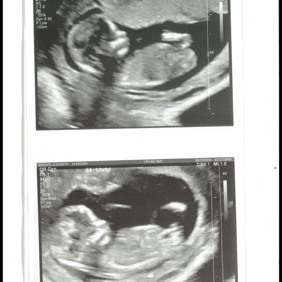 Photo shared by Elizabeth for their Babylist baby registry.