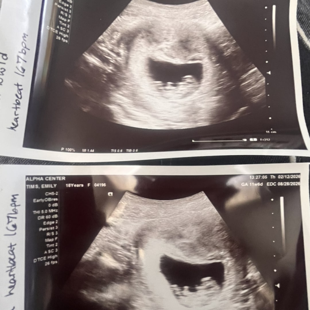 Photo shared by Emily for their Babylist baby registry.