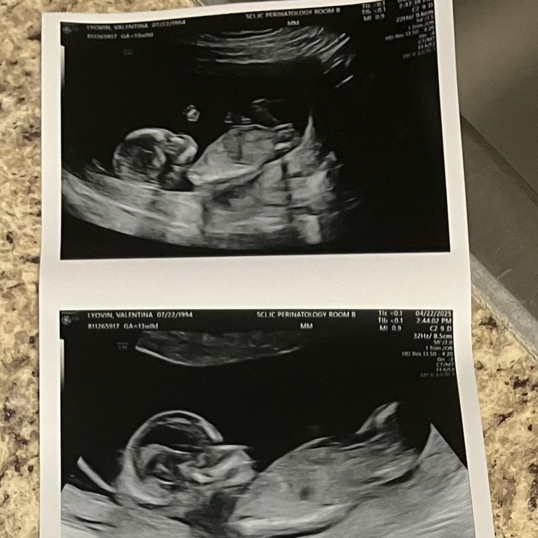 Photo shared by Valentina for their Babylist baby registry.