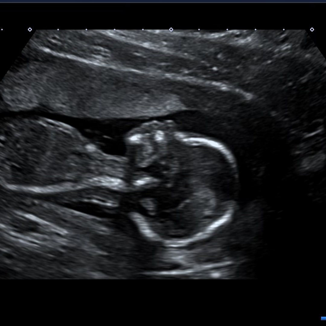 Photo shared by Rebecca for their Babylist baby registry.